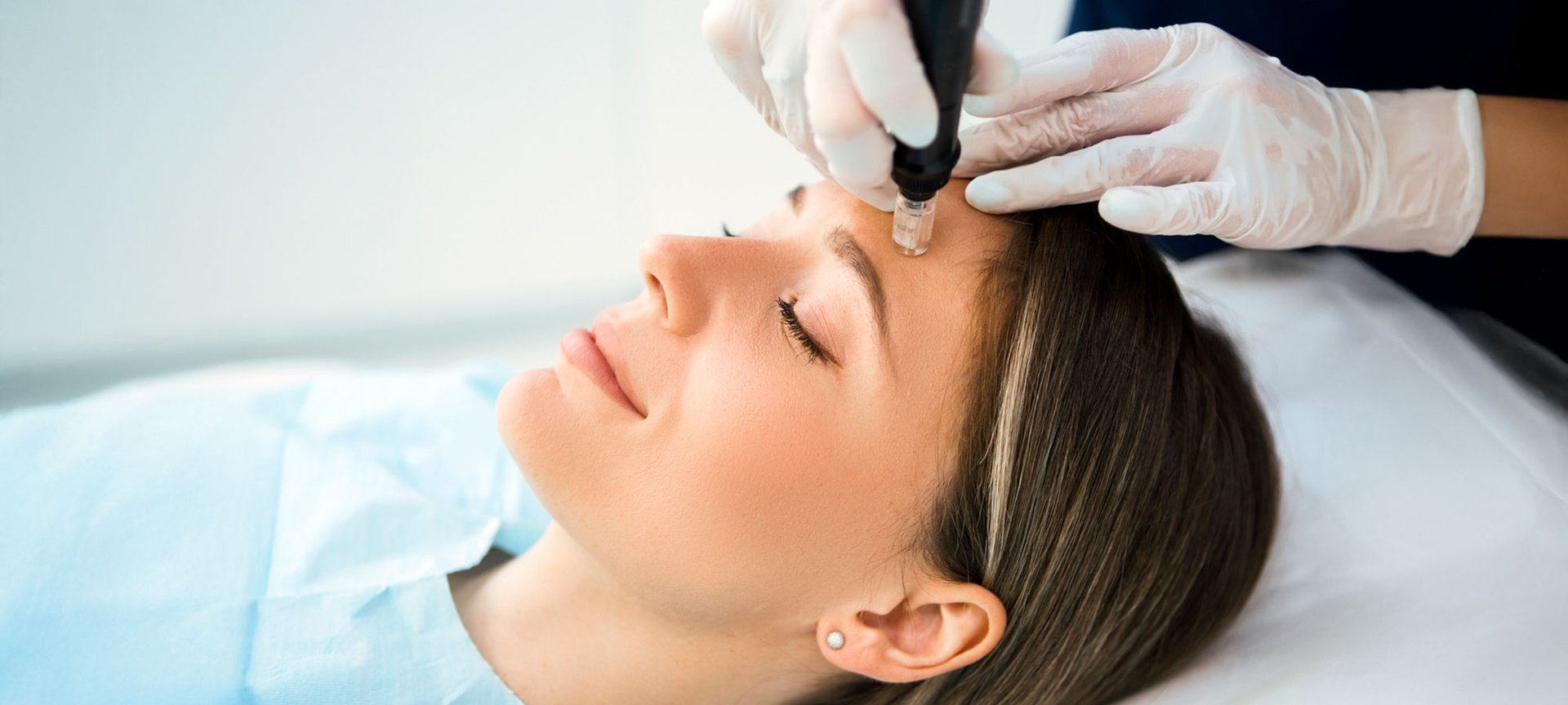Das Gesicht einer Frau im Profil. Sie liegt mit geschlossen Augen und einem leichten Lächeln da, während zwei Hände mit OP-Handschuhen ihre Stirn halten und mit einem Microneedling-Dermapen behandeln.