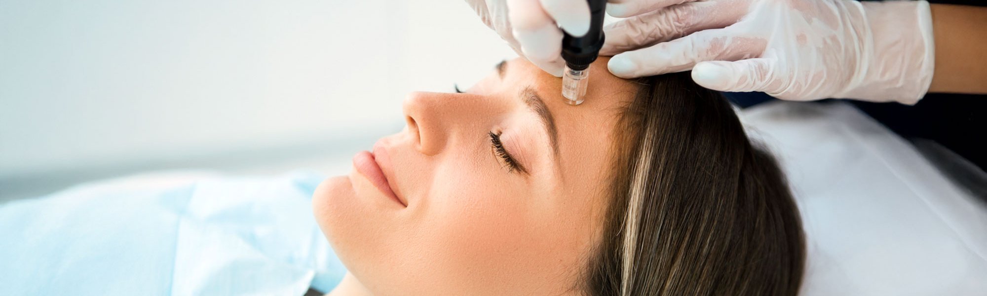Das Gesicht einer Frau im Profil. Sie liegt mit geschlossen Augen und einem leichten Lächeln da, während zwei Hände mit OP-Handschuhen ihre Stirn halten und mit einem Microneedling-Dermapen behandeln.