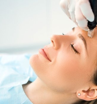 Das Gesicht einer Frau im Profil. Sie liegt mit geschlossen Augen und einem leichten Lächeln da, während zwei Hände mit OP-Handschuhen ihre Stirn halten und mit einem Microneedling-Dermapen behandeln.