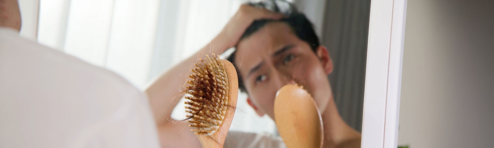 Besorgter junger Mann mit Haarausfall schaut in den Spiegel und auf seine Haarbürste