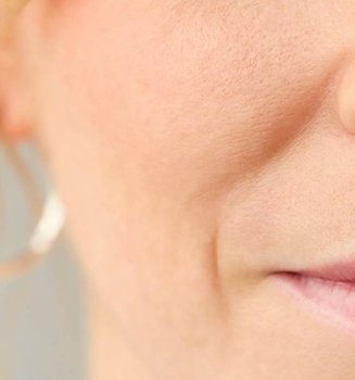 Hautpflege Nasolabialfalte Banner Image V2