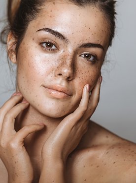 Brünette Frau hält ihre Hände an die Wangen