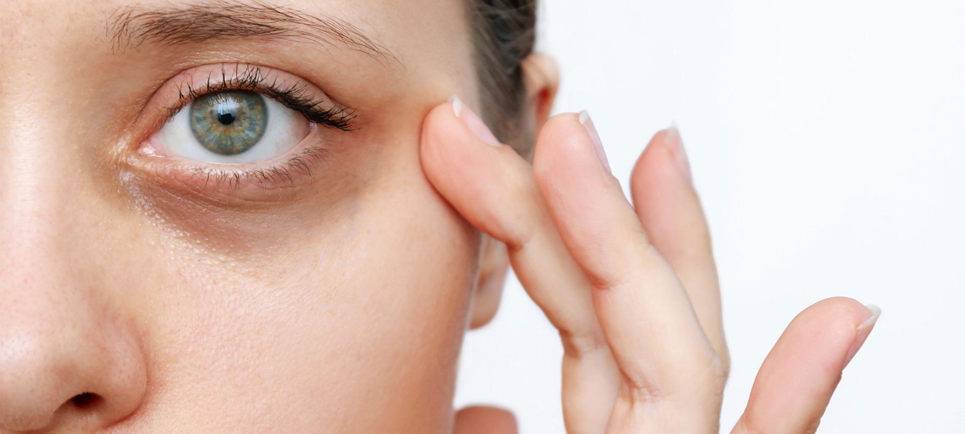 Junge Frau mit dunklen Augenringen blickt gerade aus und hält ihre linke Hand an die Schläfe.