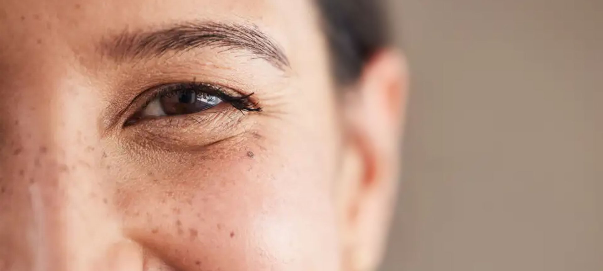 Frau mit leichten Schlupflidern lacht in die Kamera