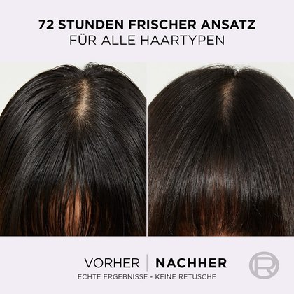 L'Oréal Entfettende Routine-Set Vorher-Nachher-Vergleich