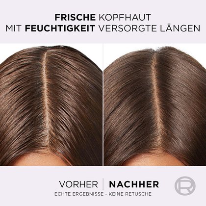 L'Oréal Entfettende Routine-Set Vorher-Nachher-Vergleich