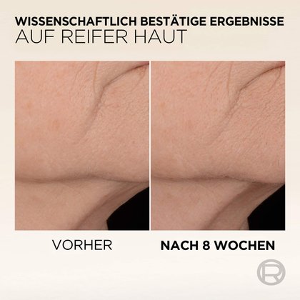 Vorher/Nachher: 8 Wochen zu sichtbar glatterer Haut, Falten gemildert. Wissenschaftlich bestätigte Anti-Aging Ergebnisse.