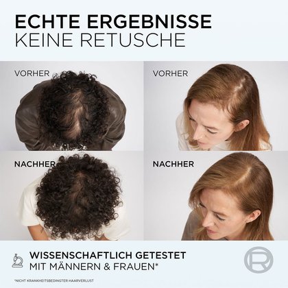 Vorher Nachher Ergebnisse zur Anwendung der Elvital Fiber Booster Spülung