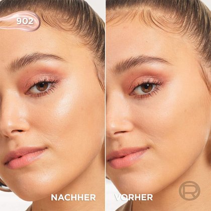 Lumi Glotion Vorher Nachher-Vergleich