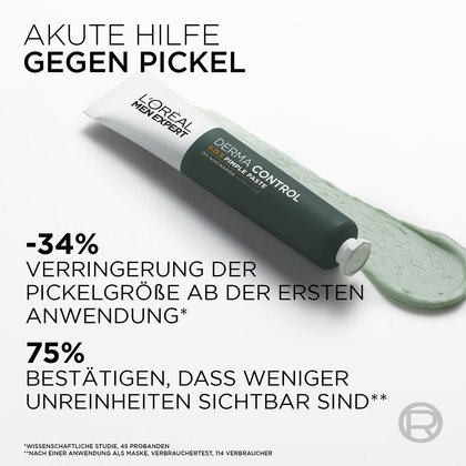 Die L'Oréal Paris SOS 2-in-1 Anti-Pickel-Paste hilft akut gegen Pickel