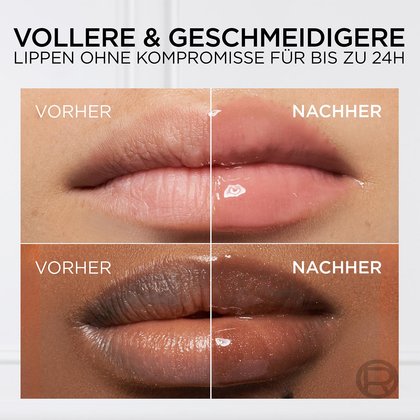 Lippen zweier Frauen mit Vorher- / Nachher-Vergleich