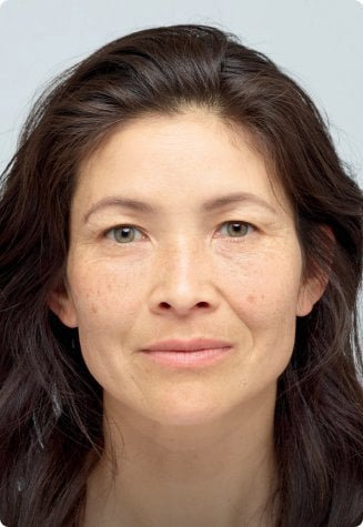 Anti-Falten-Serum: Ein Schieberegler über dem Gesicht einer Frau veranschaulicht den Vorher-Nachher-Vergleich nach 6 Wochen Anwendung des Anti-Falten-Serums