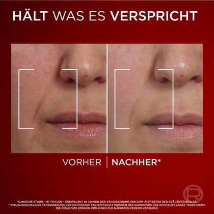 Blonde Frau trägt Laser X3 Dreifach-Power Anti-Age Nachtpflege auf die Wange auf