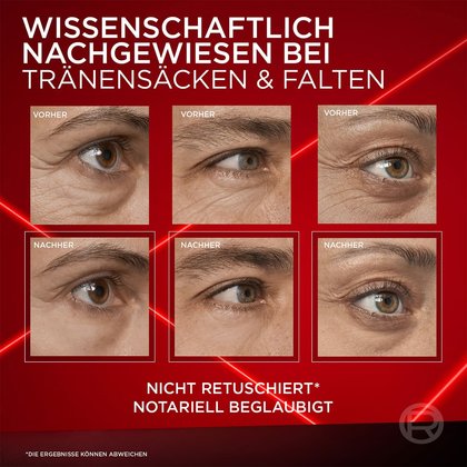 Revitalift Laser X3 Anti Age Auge rote Tube stehend und Verpackung