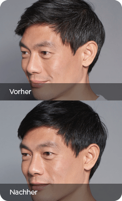 211008 MEX Vorher Nachher 3