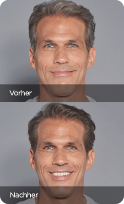 211008 MEX Vorher Nachher 4