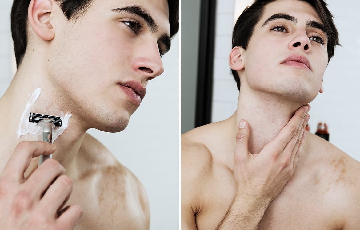 So Wirst Du Unliebsame Pickel Los L Oreal Men Expert