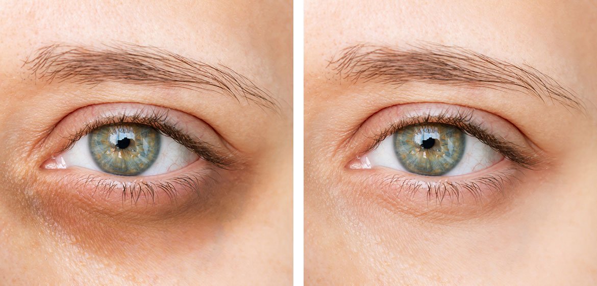Augenringe abdecken leicht gemacht L’Oréal Paris