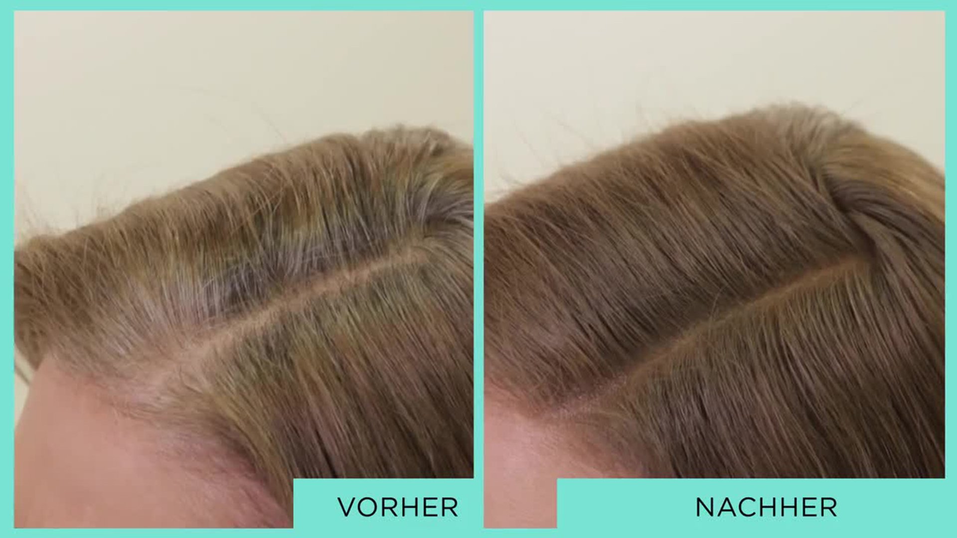 Graue Haare Abdecken Mit Magic Retouch L Oreal Paris