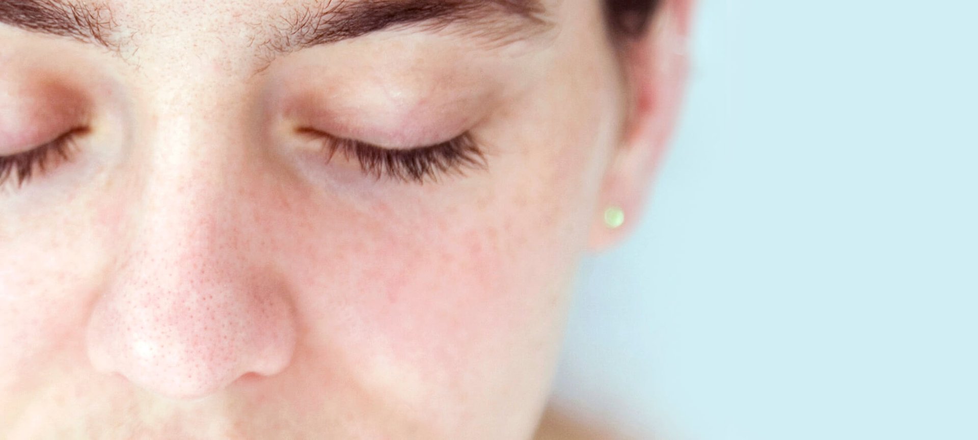 Hypoallergenic A Magic Word For Sensitive Skin Article